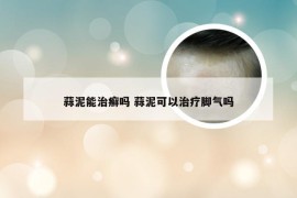 蒜泥能治癣吗 蒜泥可以治疗脚气吗