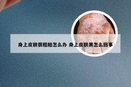 身上皮肤很粗糙怎么办 身上皮肤黑怎么回事