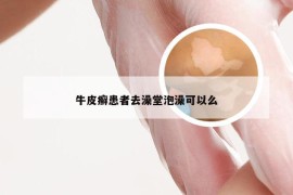 牛皮癣患者去澡堂泡澡可以么