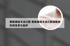 银屑病涂卡泊三醇 银屑病涂卡泊三醇倍他米松软膏多久能好