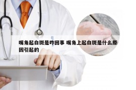 嘴角起白斑是咋回事 嘴角上起白斑是什么原因引起的