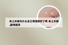 身上长癣为什么自己慢慢就好了呢 身上长癣,越来越多