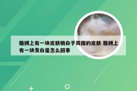 胳膊上有一块皮肤稍白于周围的皮肤 胳膊上有一块发白是怎么回事