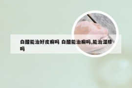 白醋能治好皮癣吗 白醋能治癣吗,能治湿疹吗