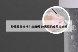 炒黑豆能治疗牛皮癣吗 炒黑豆的皮可以吃吗