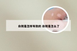 白斑是怎样导致的 白斑是怎么了