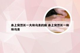 身上突然长一大块乌青的癣 身上突然长一块块乌青