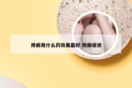 阴癣用什么药效果最好 阴癣症状