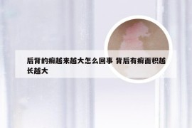 后背的癣越来越大怎么回事 背后有癣面积越长越大