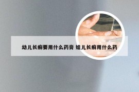 幼儿长癣要用什么药膏 娃儿长癣用什么药