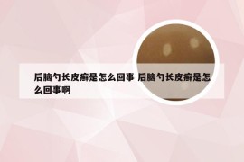 后脑勺长皮癣是怎么回事 后脑勺长皮癣是怎么回事啊