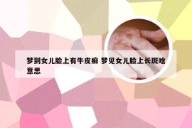 梦到女儿脸上有牛皮癣 梦见女儿脸上长斑啥意思