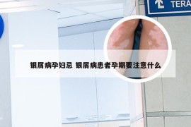 银屑病孕妇忌 银屑病患者孕期要注意什么