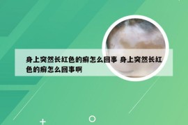 身上突然长红色的癣怎么回事 身上突然长红色的癣怎么回事啊