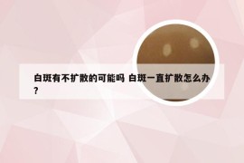 白斑有不扩散的可能吗 白斑一直扩散怎么办?