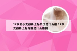 12岁的小女孩身上起白斑是什么病 12岁女孩身上起疙瘩是什么原因