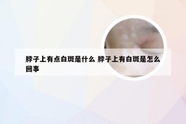 脖子上有点白斑是什么 脖子上有白斑是怎么回事