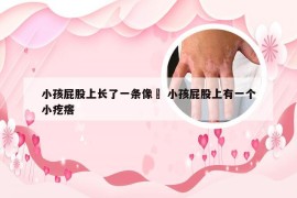 小孩屁股上长了一条像廯 小孩屁股上有一个小疙瘩