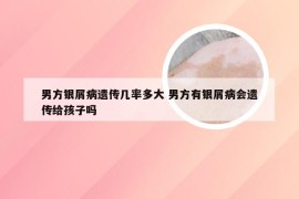 男方银屑病遗传几率多大 男方有银屑病会遗传给孩子吗