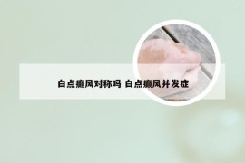 白点癫风对称吗 白点癫风并发症