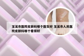 玉溪市医院皮肤科哪个医生好 玉溪市人民医院皮肤科哪个看得好