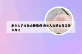 老年人的皮肤会传染吗 老年人皮肤会发生什么变化