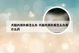 大腿内测长癣怎么办 大腿内测长癣怎么办用什么药