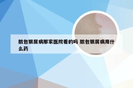 脓包银屑病那家医院看的吗 脓包银屑病用什么药