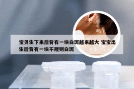 宝贝生下来后背有一块白斑越来越大 宝宝出生后背有一块不规则白斑