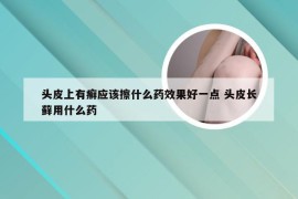 头皮上有癣应该擦什么药效果好一点 头皮长藓用什么药