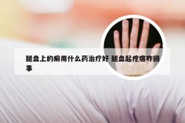 腿盘上的癣用什么药治疗好 腿盘起疙瘩咋回事