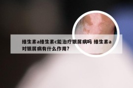 维生素a维生素c能治疗银屑病吗 维生素a对银屑病有什么作用?