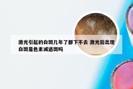 激光引起的白斑几年了都下不去 激光后出现白斑是色素减退斑吗