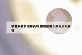 银屑病要长期用药吗 银屑病要长期用药吗女性