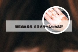 银屑病化妆品 银屑病用什么化妆品好