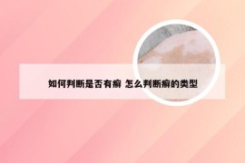 如何判断是否有癣 怎么判断癣的类型