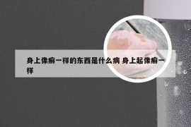 身上像癣一样的东西是什么病 身上起像癣一样