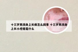 十三岁男孩身上长癣怎么回事 十三岁男孩身上长小疙瘩是什么