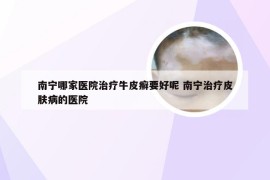 南宁哪家医院治疗牛皮癣要好呢 南宁治疗皮肤病的医院