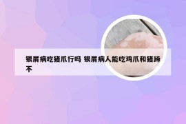 银屑病吃猪爪行吗 银屑病人能吃鸡爪和猪蹄不