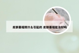 皮肤萎缩斑什么引起的 皮肤萎缩能治好吗