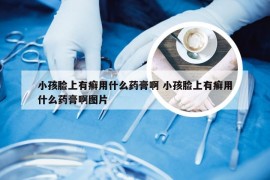 小孩脸上有癣用什么药膏啊 小孩脸上有癣用什么药膏啊图片