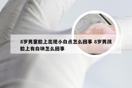 8岁男童脸上出现小白点怎么回事 8岁男孩脸上有白块怎么回事