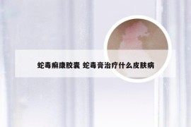 蛇毒癣康胶囊 蛇毒膏治疗什么皮肤病