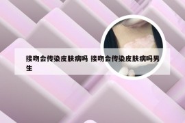 接吻会传染皮肤病吗 接吻会传染皮肤病吗男生