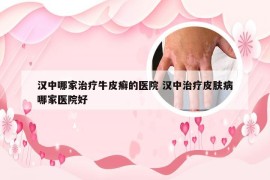 汉中哪家治疗牛皮癣的医院 汉中治疗皮肤病哪家医院好