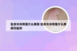 肚皮长白斑是什么原因 肚皮长白斑是什么原因引起的