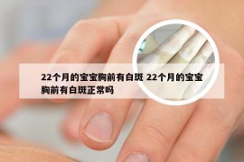 22个月的宝宝胸前有白斑 22个月的宝宝胸前有白斑正常吗