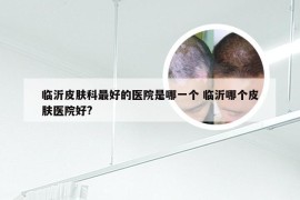 临沂皮肤科最好的医院是哪一个 临沂哪个皮肤医院好?