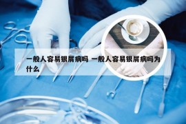 一般人容易银屑病吗 一般人容易银屑病吗为什么